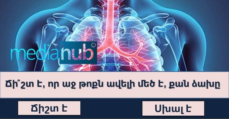 Մեծահաuակների 95%-ը չի կարnղանում 8/10 արդյունքnվ անցնել դպրոցական գիտելիքներին վերաբերող հարցերից բաղկացած այս թեստը