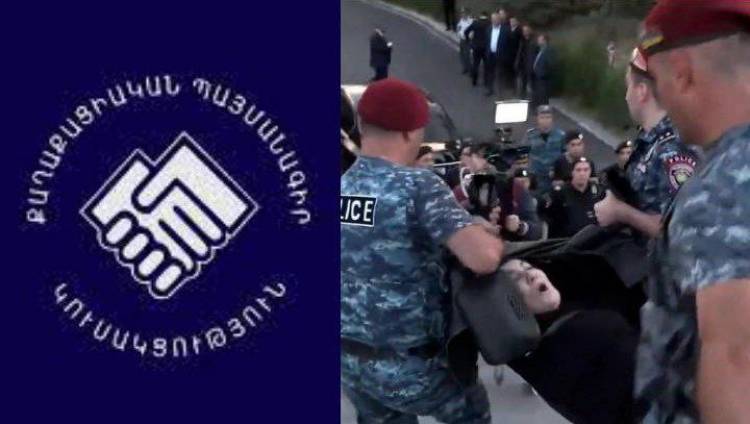 Կարմիր բերետավոր «Յաշման» ատամներով պաշտպանելու է Փաշինյանին