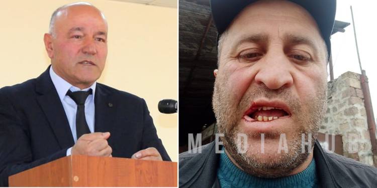 ՊՆ խորհրդական Մելիքսեթ Պողոսյանի «մաֆիան» ինձ ծեծի է ենթարկել․ ծեծկռտուք՝ Տեղ գյուղում
